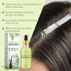 Ouhoe Herbal Hair Care Essential Oil Hydrates And s Dry Hair, Smoothing And Thickening Hair Care Oil